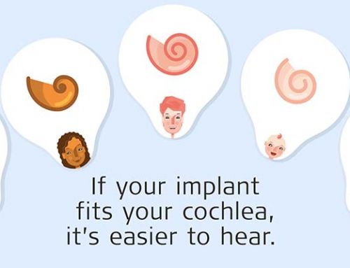 Was ist ein individualisiertes Cochlea-Implantat?